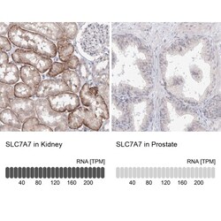 SLC7A7 Antibody, Novus Biologicals 25 &mu;L; Unlabeled:Antibodies, Polyclonal